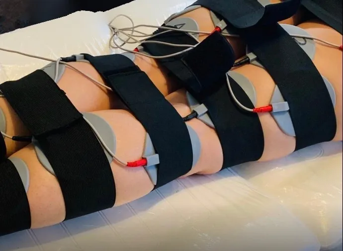 Microcurrent pads positioned for a muscle-stimulation session